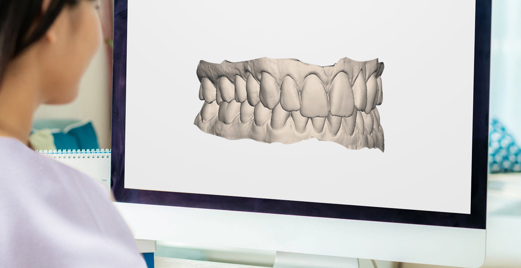 See Your New Smile | At-Home Clear Braces